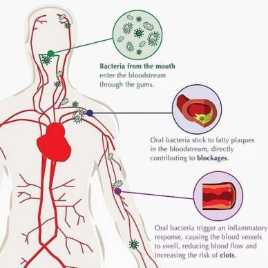 How oral bacteria move through your body